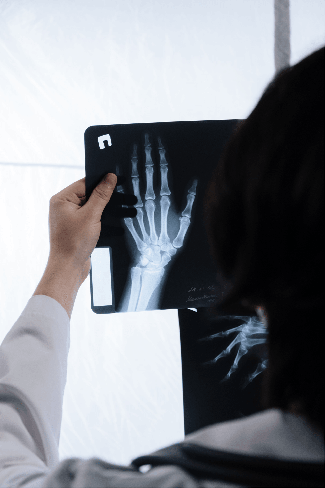 Hand and wrist x-ray relating to carpal tunnel syndrome at Crest Hill Clinic